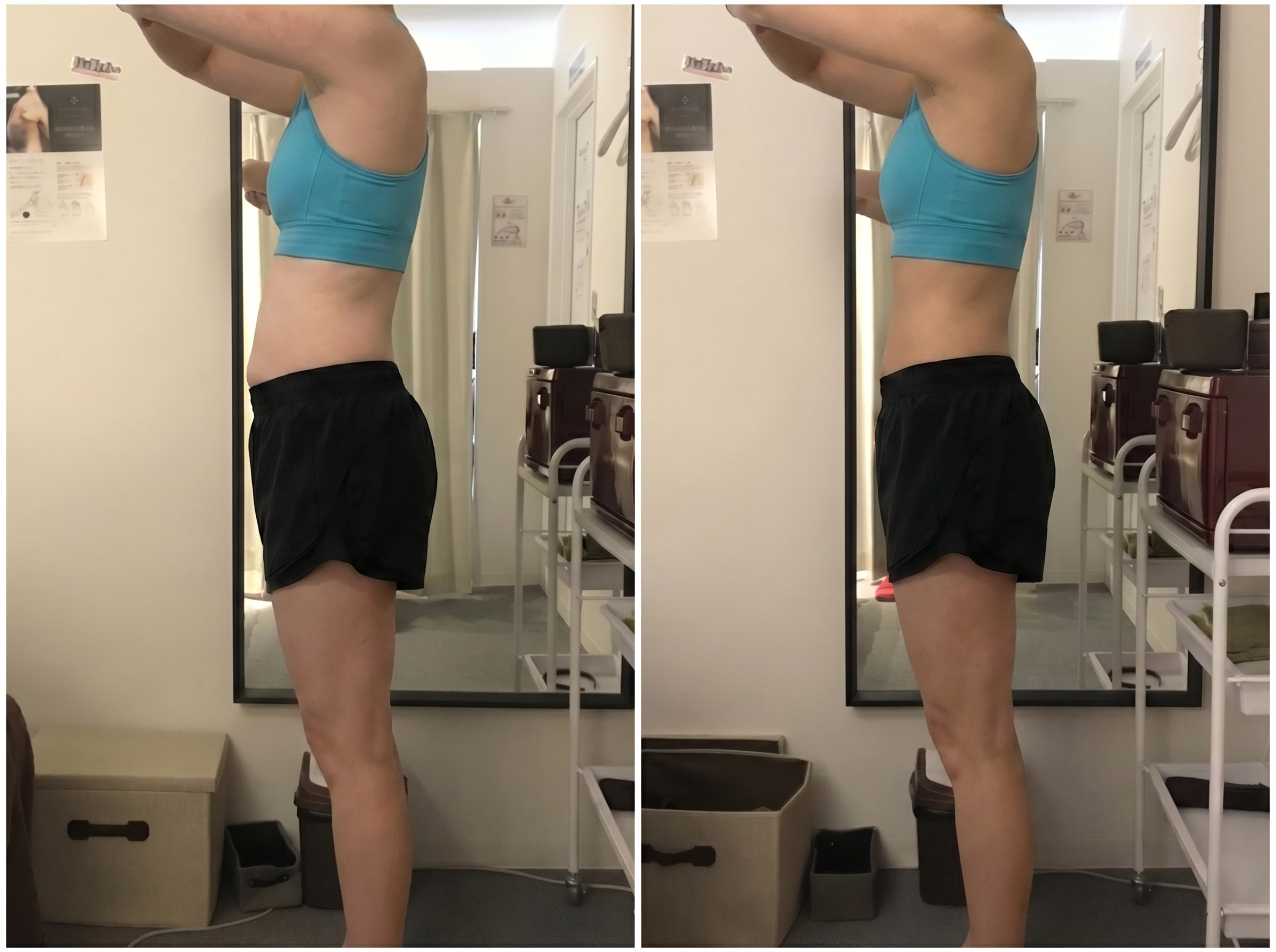 CASE 02 Before After